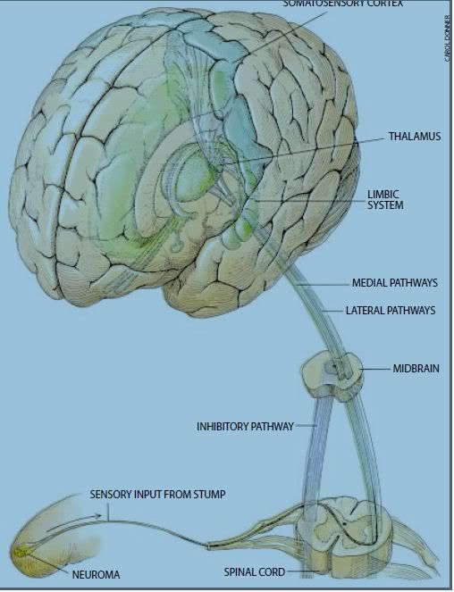 Neural pathway from neuroma to somatosensory cortex